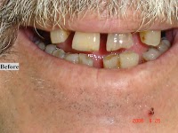 Robert Collins Dental Prosthetist 177379 Image 3