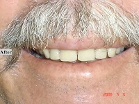 Robert Collins Dental Prosthetist 177379 Image 4