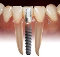 The Dental Implant Centre 171676 Image 0