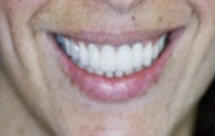 Tooronga Family Dentistry, Dr Daniel Kaufman, Inhalation sedation,CosmeticDental 172647 Image 0
