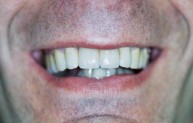 Tooronga Family Dentistry, Dr Daniel Kaufman, Inhalation sedation,CosmeticDental 172647 Image 1