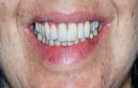 Tooronga Family Dentistry, Dr Daniel Kaufman, Inhalation sedation,CosmeticDental 172647 Image 2