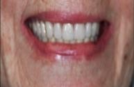 Tooronga Family Dentistry, Dr Daniel Kaufman, Inhalation sedation,CosmeticDental 172647 Image 4
