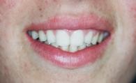 Tooronga Family Dentistry, Dr Daniel Kaufman, Inhalation sedation,CosmeticDental 172647 Image 5
