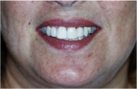 Tooronga Family Dentistry, Dr Daniel Kaufman, Inhalation sedation,CosmeticDental 172647 Image 6