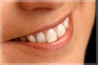 Uniquely You Teeth Whitening 179501 Image 0