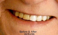 Uniquely You Teeth Whitening 179501 Image 5